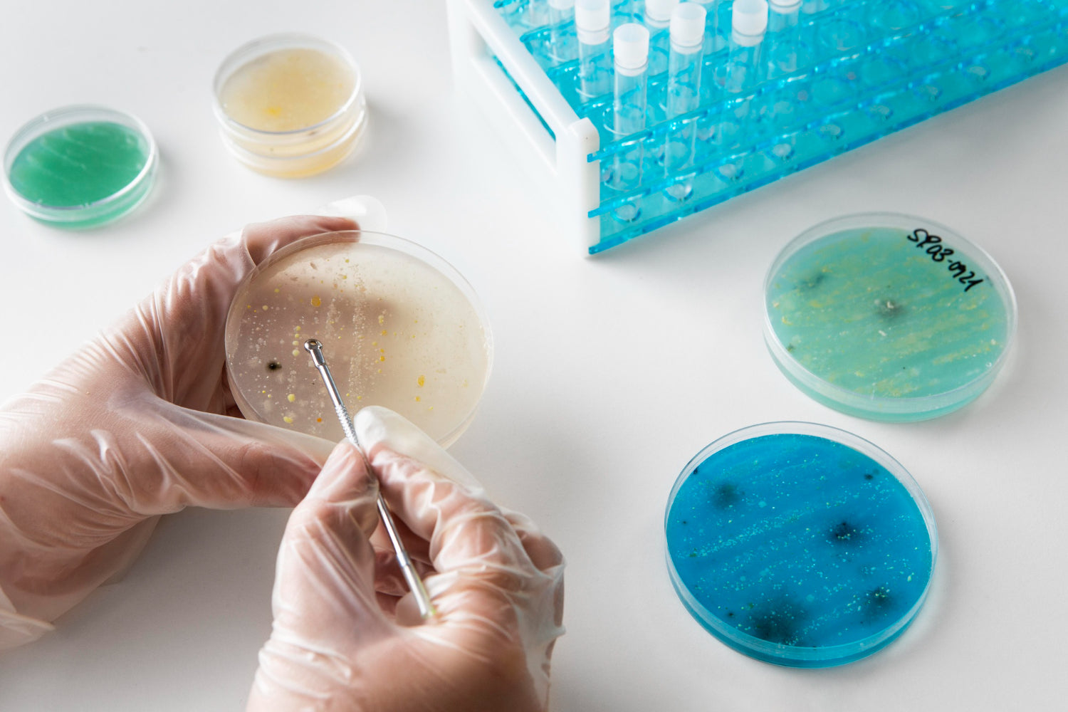 Asas y Agujas Bacteriológicas: Herramientas de Precisión en la Siembra Microbiana