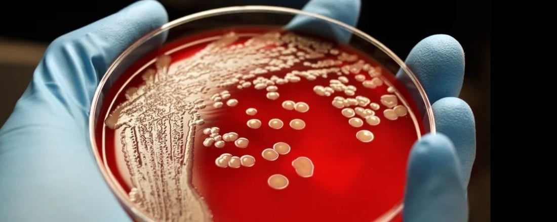Trimetoprima-Sulfametoxazol: El Antibiótico Combinado que Combate Infecciones - Mercalab